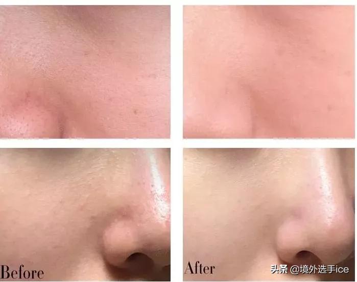 科颜氏亚马逊白泥面膜,科颜氏亚马逊白泥面膜怎么用的