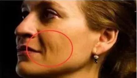 皱纹变多的症状,最近为什么突然有皱纹了