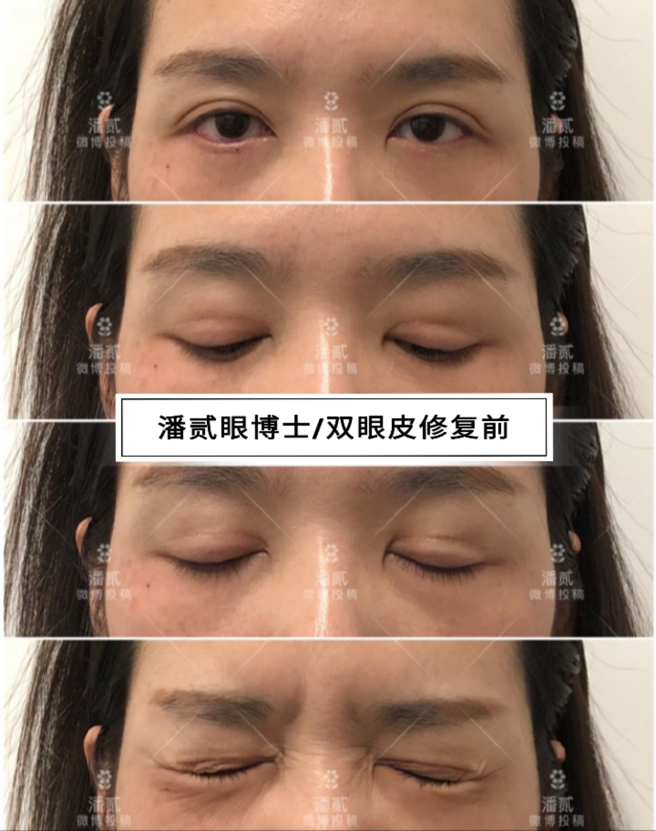 <html>
<head><title>502BadGateway</title></head>
<body>
<center><h1>502BadGateway</h1></center>
<hr><center>nginx</center>
</body>
</html>
<!--apaddingtodisableMSIEandChromefriendlyerrorpage-->
<!--apaddingtodisableMSIEandChromefriendlyerrorpage-->
<!--apaddingtodisableMSIEandChromefriendlyerrorpage-->
<!--apaddingtodisableMSIEandChromefriendlyerrorpage-->
<!--apaddingtodisableMSIEandChromefriendlyerrorpage-->
<!--apaddingtodisableMSIEandChromefriendlyerrorpage-->
