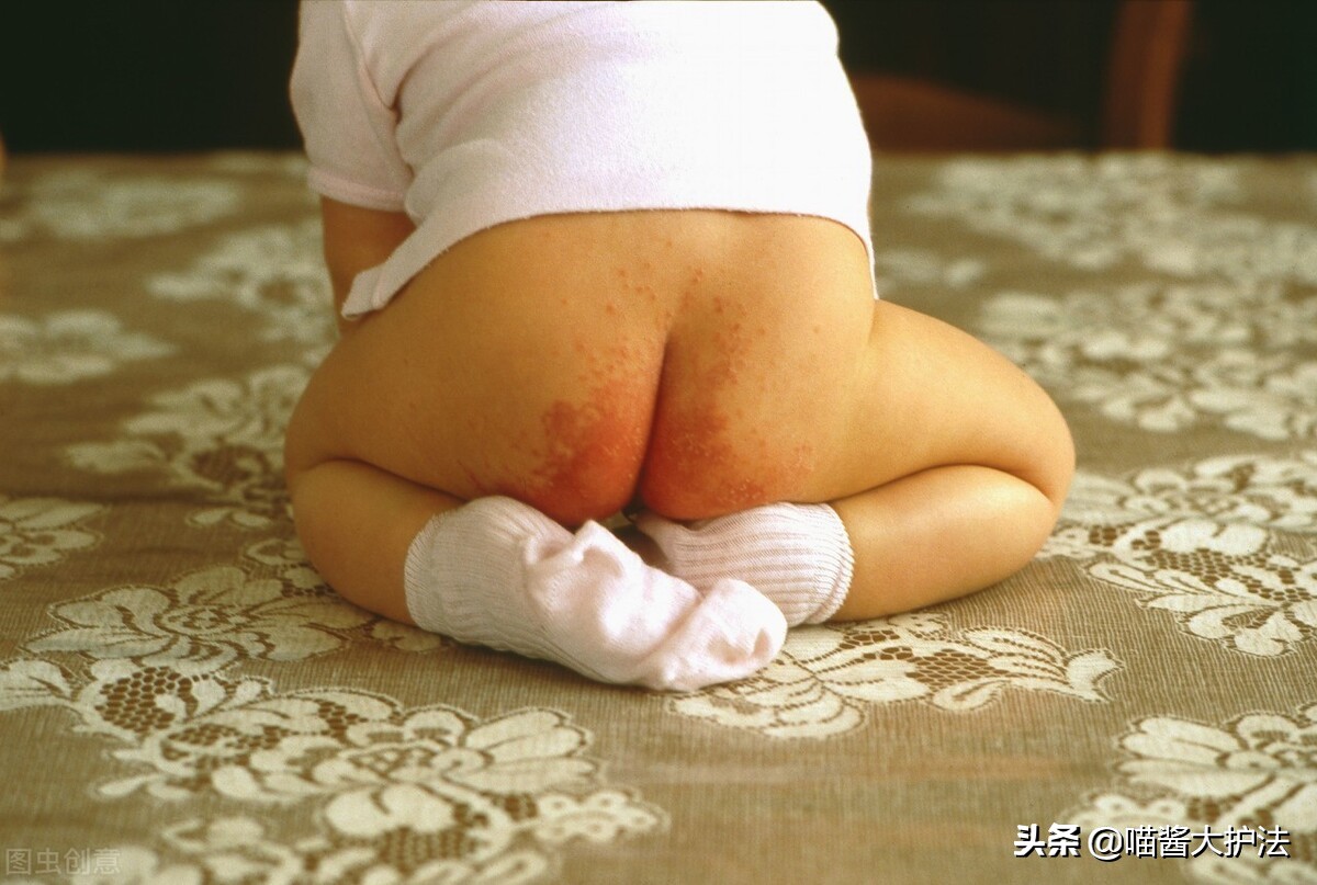 宝宝红屁股了好难过,宝宝红屁股了怎么回击