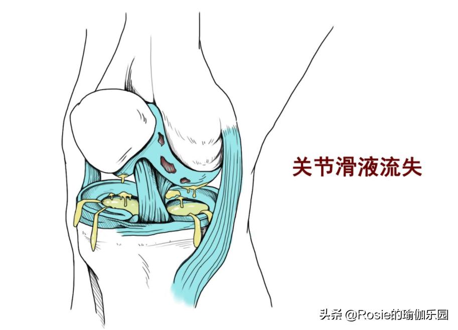 爱穿高跟鞋带来的烦恼,爱穿高跟鞋如何保护脚
