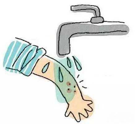 猫狗抓伤最佳处理时间是,猫狗抓伤如何处理伤口