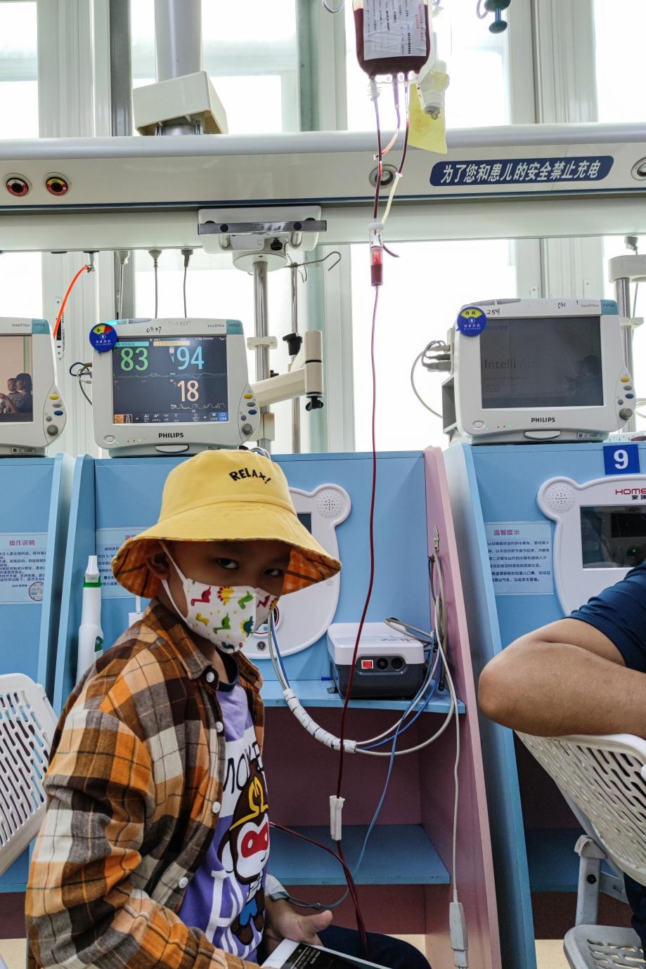 八岁男孩腋下好多红疙瘩,小朋友腋下有一片红疙瘩