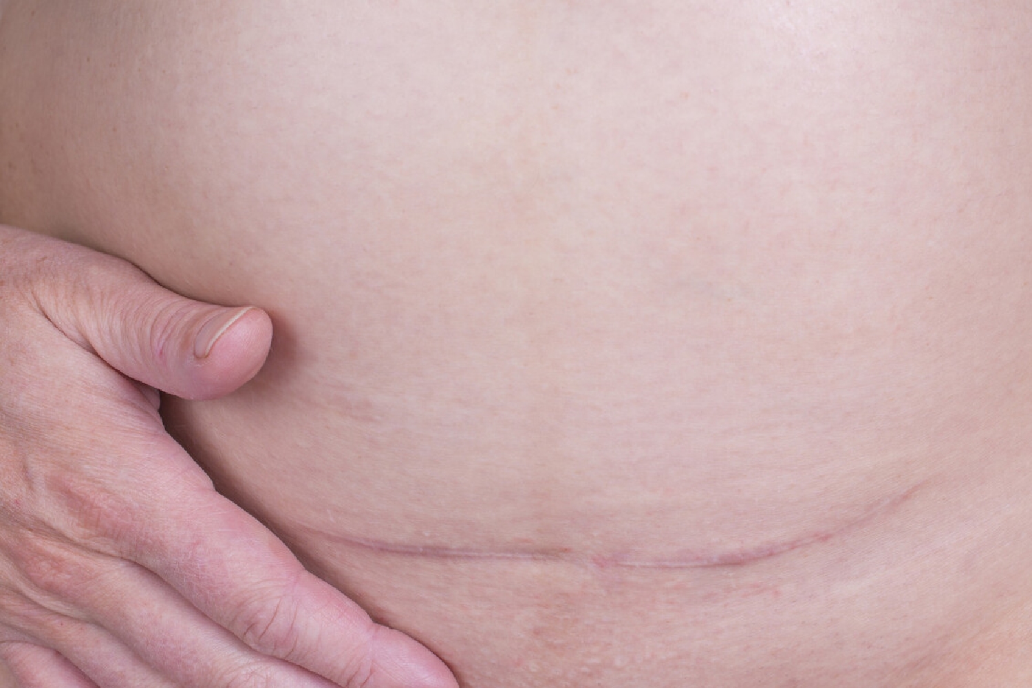 顺产和剖腹产的好处和坏处,剖腹产的好处和坏处有哪些