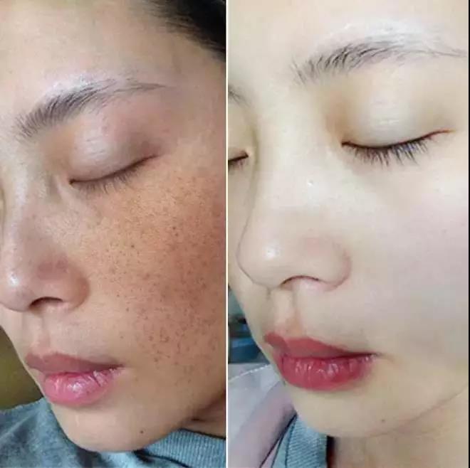 女人刚过30就肤色暗黄？想要“换皮”，先搞清楚这3件事