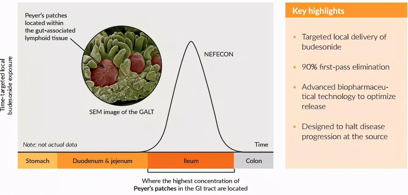 布地奈德新药,布地奈德缓释胶囊治疗iga肾病么