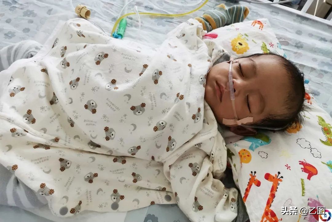 世上最悲催的婴儿,人间悲惨的孩子