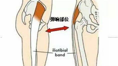 小时候青霉素打多了会影响智商吗,小时候打青霉素针导致的腿变形