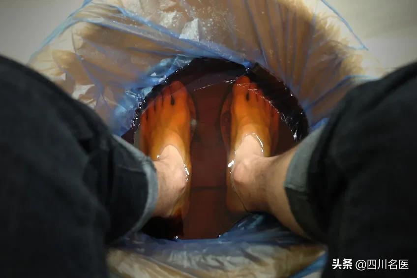 脚气脚臭怎么办教你除根,脚气和脚臭解决办法图解