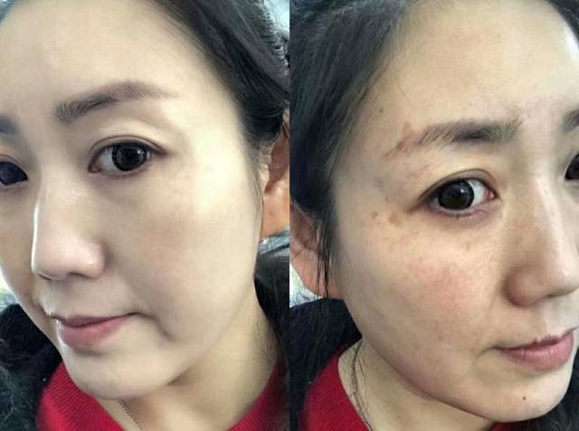 孕期可以用抗衰老的护肤品吗,孕期也可以精致护肤