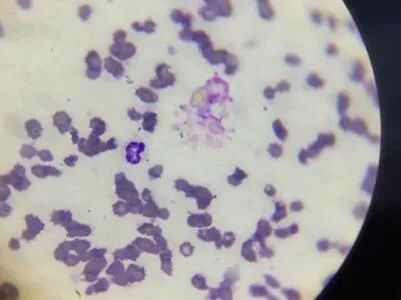 猫鼻支的症状和治疗方法,猫鼻支的症状及治疗方法