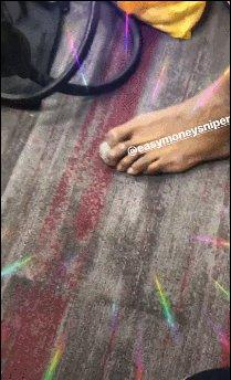 意欲何为？格林曝光杜兰特畸形脚趾！其实这是勇士的好消息！