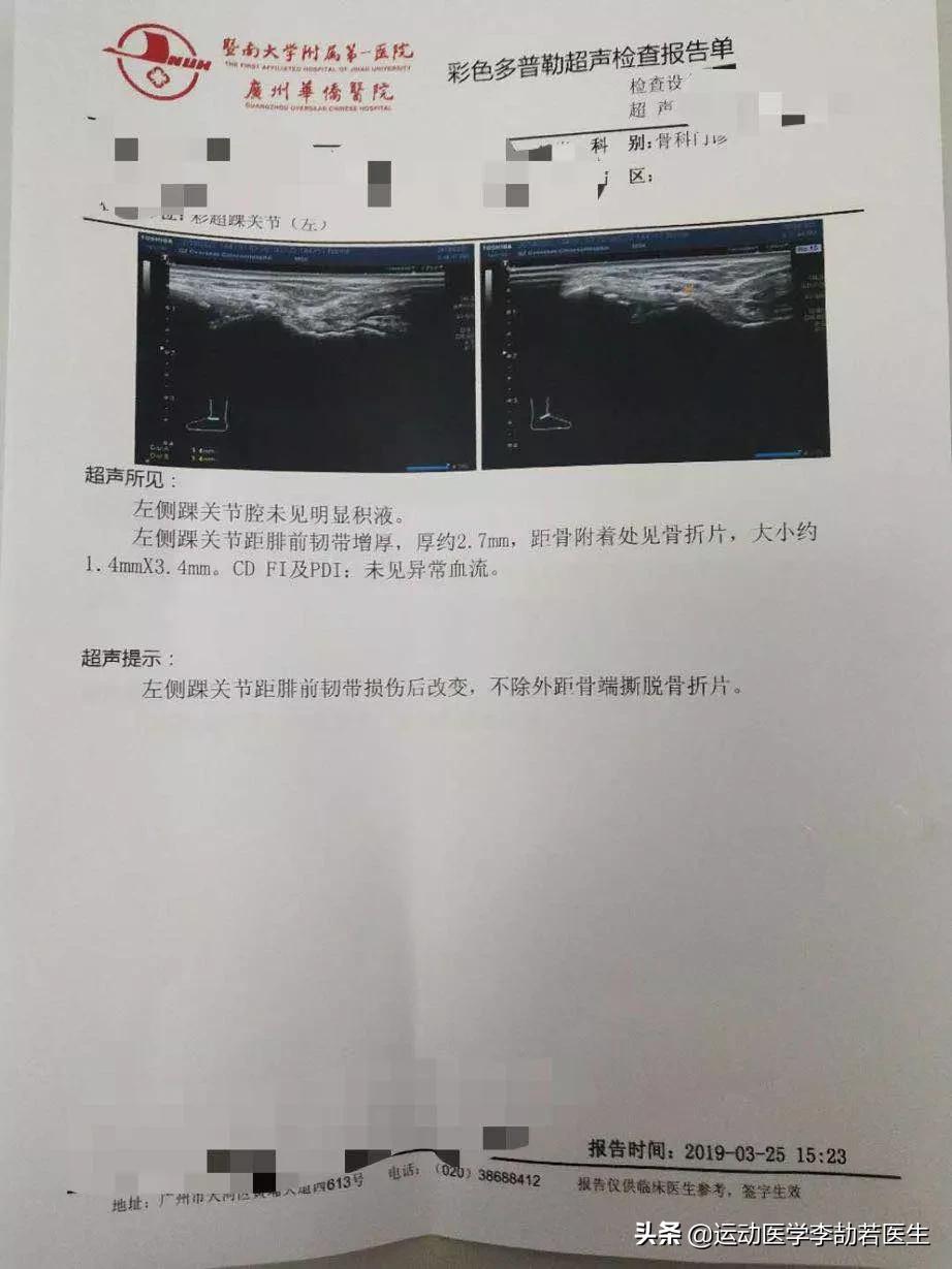外踝关节扭伤怎么办,踝关节扭伤常用药
