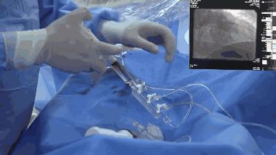 区域急危重症救治,29种危急重症急救流程图解