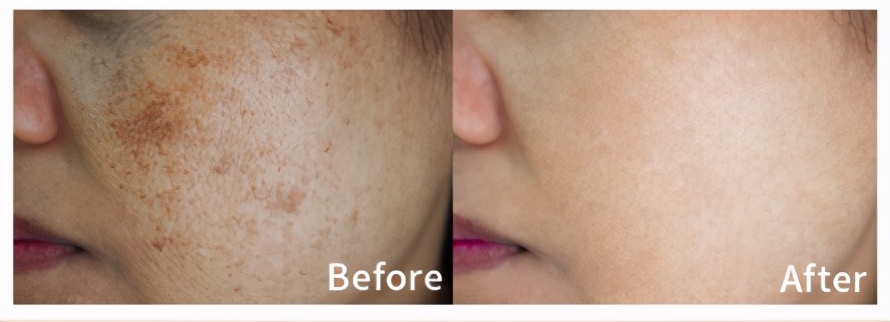 老字号祛斑面霜,一瓶祛斑的面霜