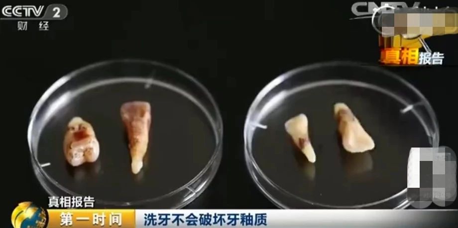 洗牙会伤害牙齿科普,洗牙会破坏牙保护膜么