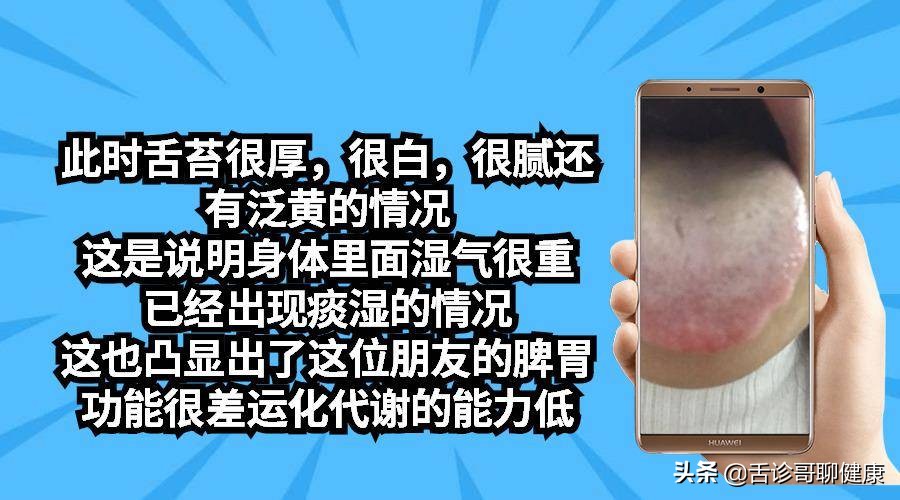 舌诊哥肝郁脾虚,抖音舌诊哥的感悟