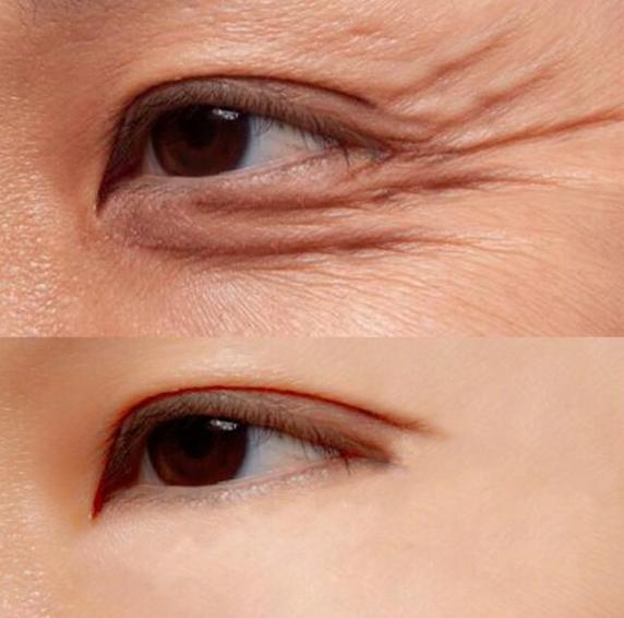 人老先老眼抗皱眼霜,人老眼先老眼部保养很重要