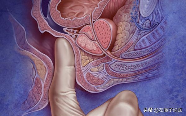 肠癌与肠肿瘤有区别吗,肠癌和痔疮有直接关系吗