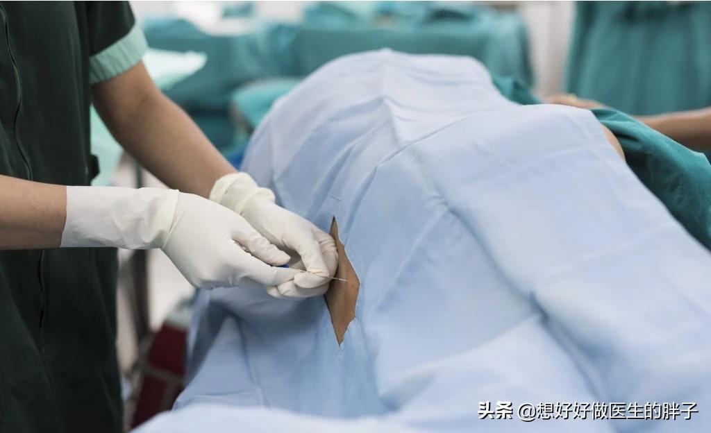 腰椎间盘突出髓核脱出要动手术吗,腰间盘脱出髓核游离能保守治疗吗