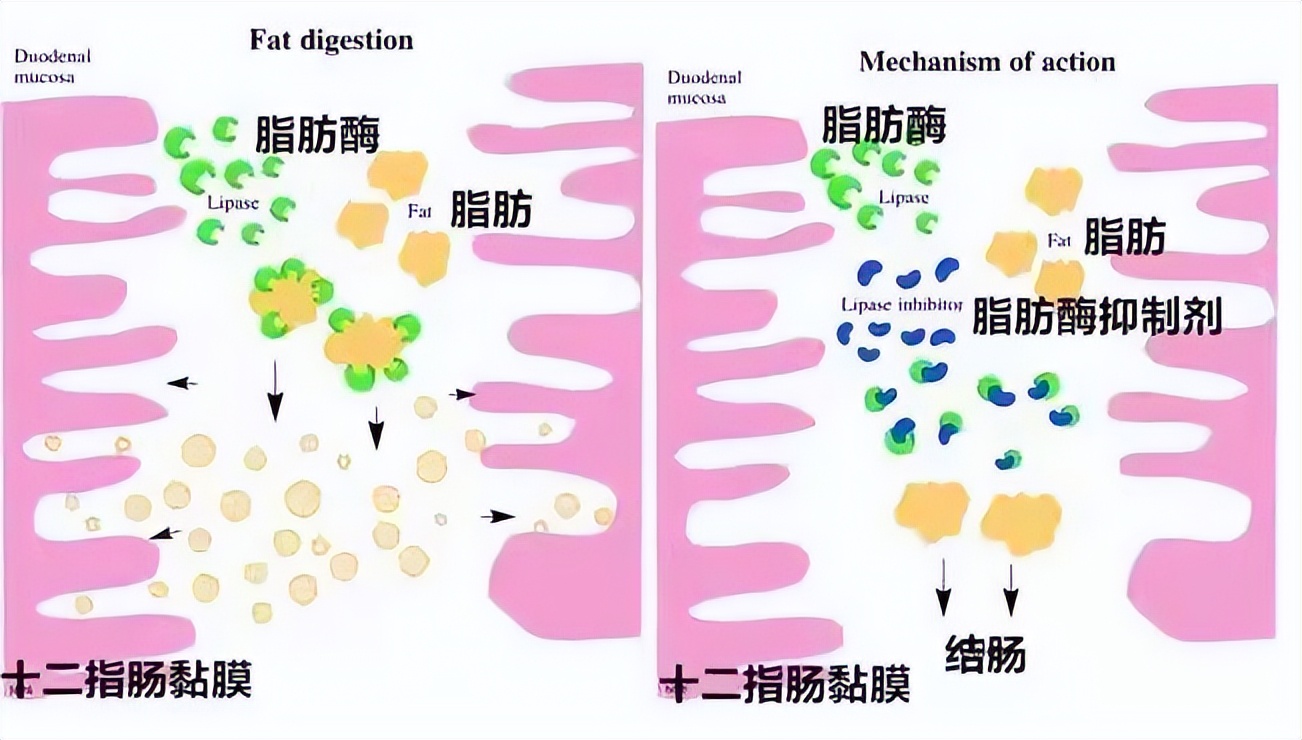 奥利司他胶囊能减体内脂肪吗,我国批准的减肥药物