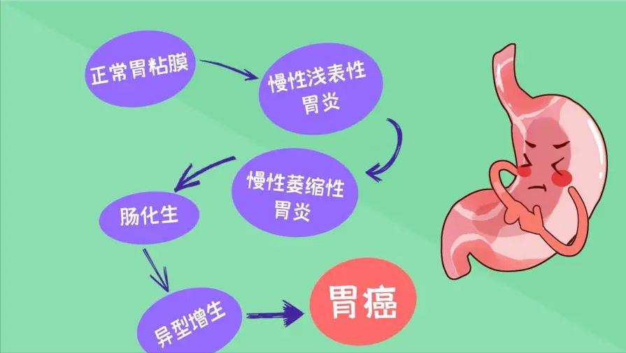 幽门螺杆菌治好后会反复感染吗,幽门螺杆菌导致十二指肠球炎反复