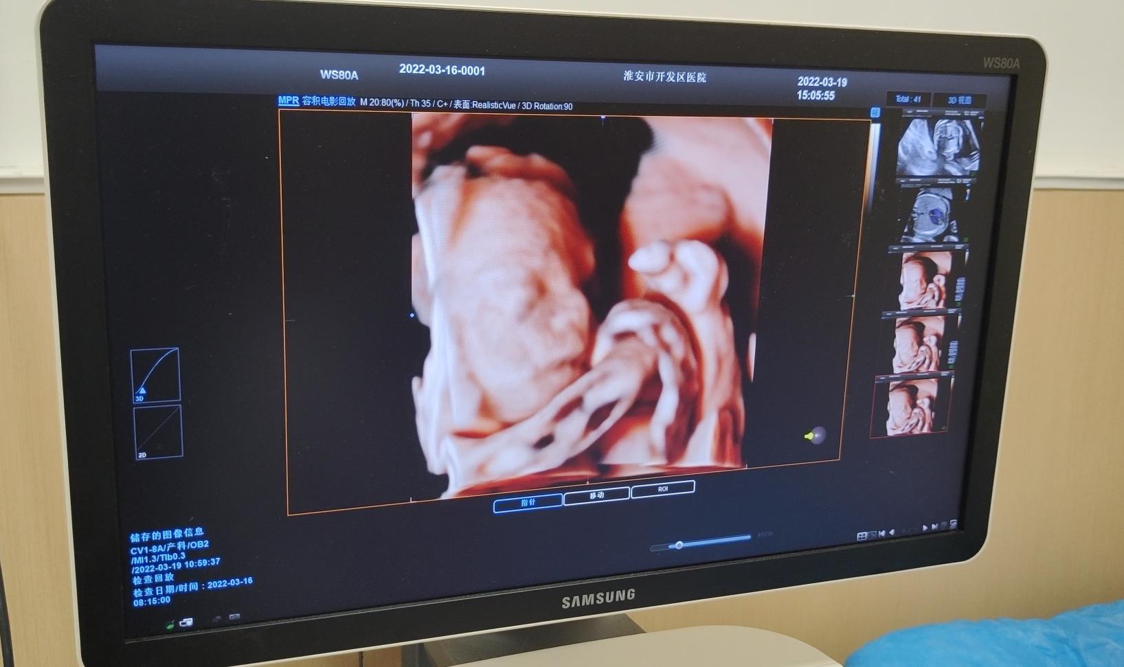 一干就是40年！专访淮安经济技术开发区医院妇产科主任蔡冰