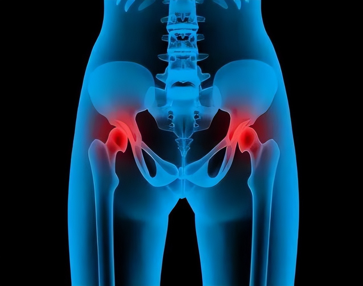 股骨头取钉后坏死有什么症状,男性患股骨头坏死的全身症状