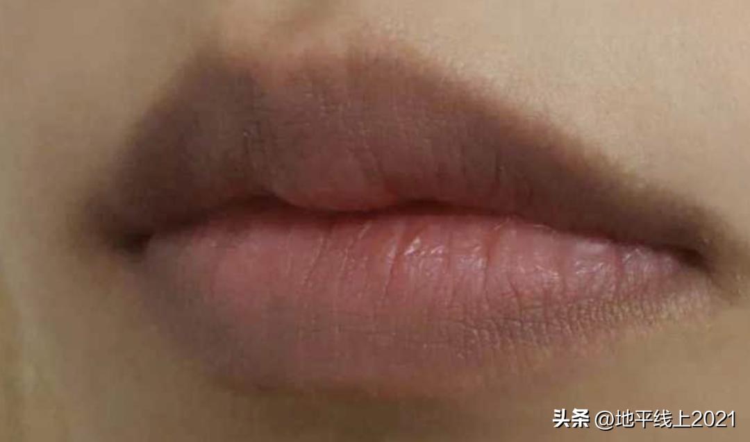唇色深怎么办怎么变淡,唇色深怎么办四大技巧改善唇色深