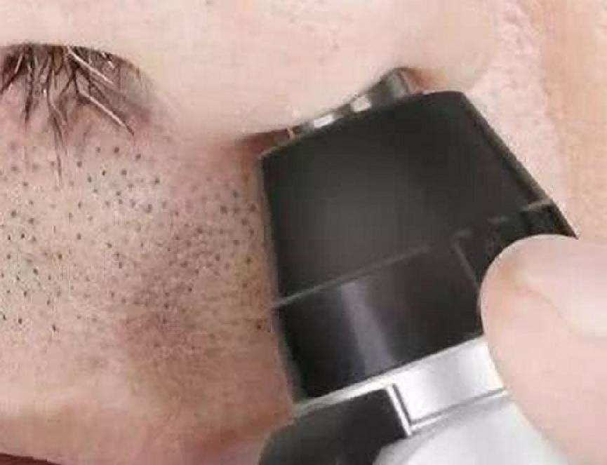 鼻毛为什么经常窜出来,鼻毛老是长出来是好还是坏