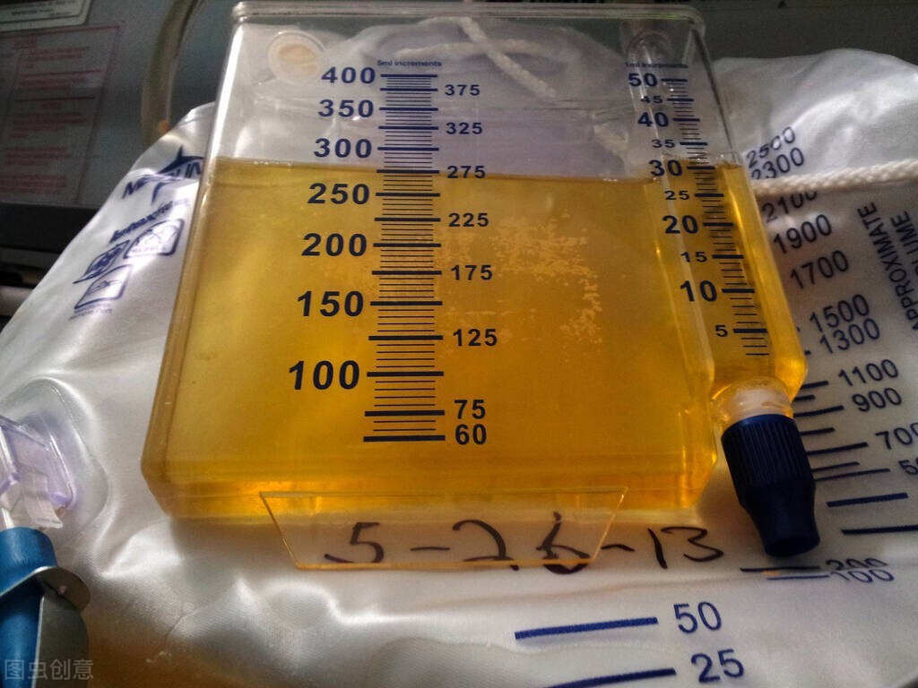 利尿类的降压药有哪些,所有的利尿药都有降压效果吗