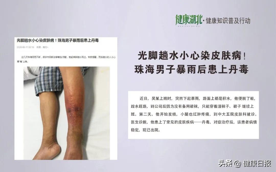 皮肤病的问题全在这里,皮肤病的10大问题