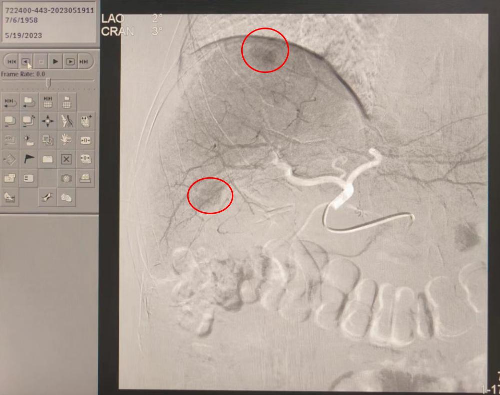 岳阳市湘岳医院,湖南省岳阳市湘岳医院