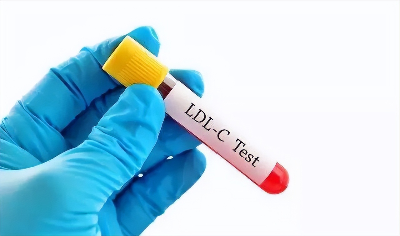 颈动脉斑块得脑梗几率多大,发现颈动脉斑块吃啥药