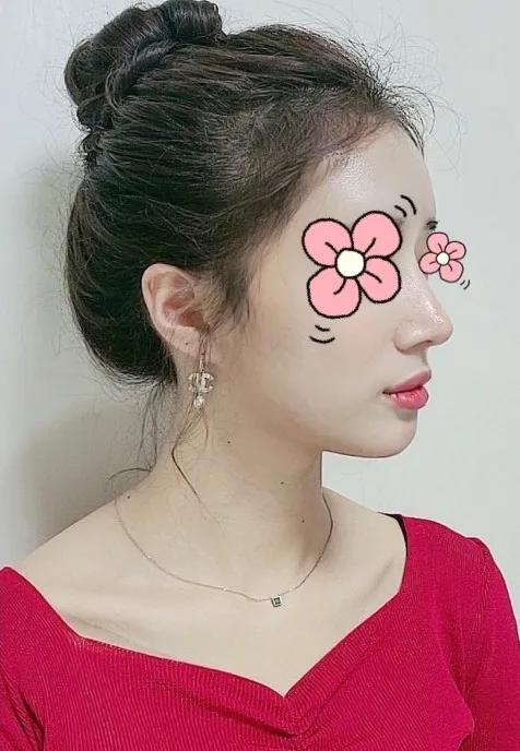 五官扁平脸怎么变高级感,扁平脸塌鼻子怎么改善