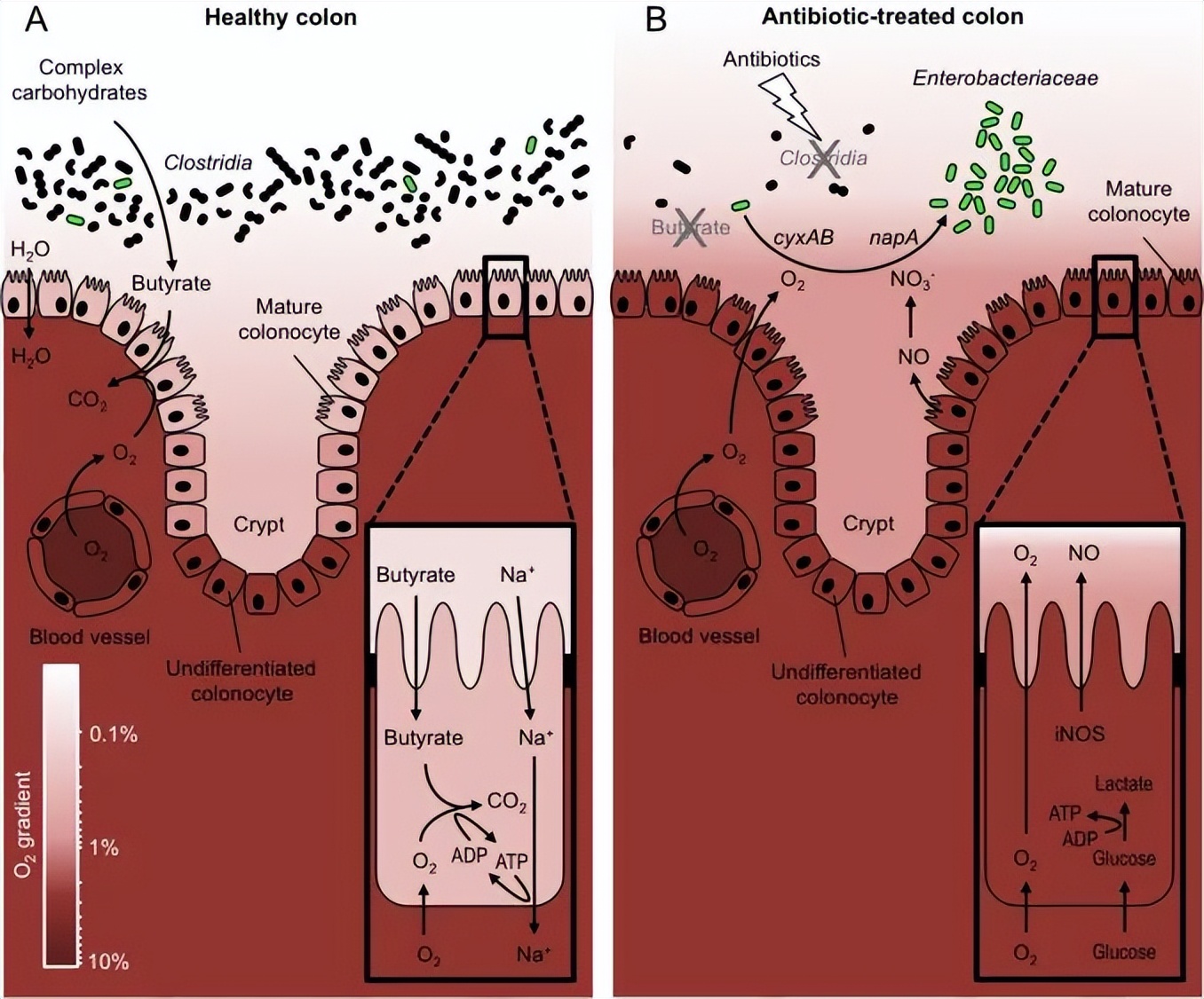 肠道侧漏会是什么症状,肠道渗漏什么意思