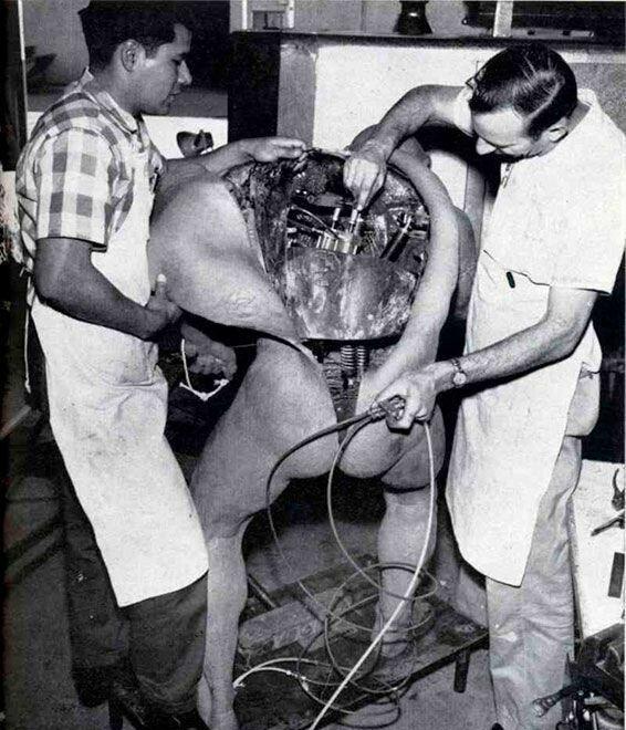 15个荒诞实事：印度征收“乳房税”，阴道里长了“一颗牙”