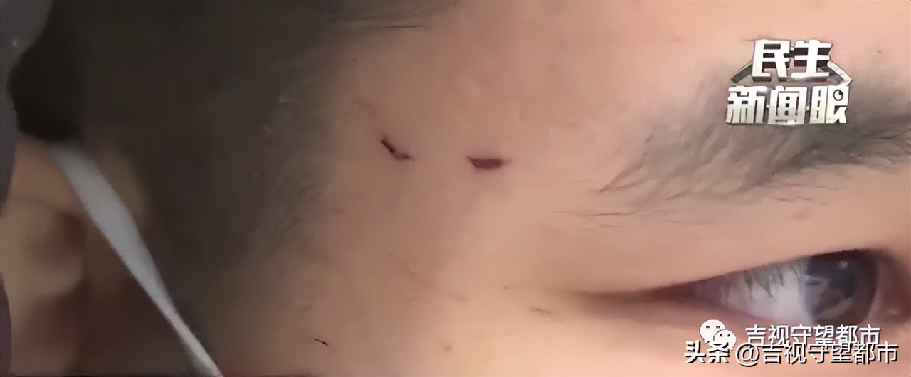 乘坐公交车受伤怎么赔偿,乘客坐公交未扶稳受伤谁的责任