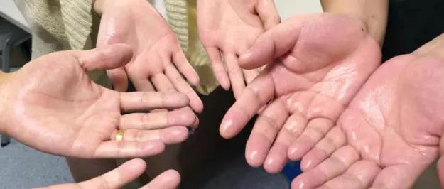 男人手心脚心出汗是什么病,男人手心脚心出汗是什么症状