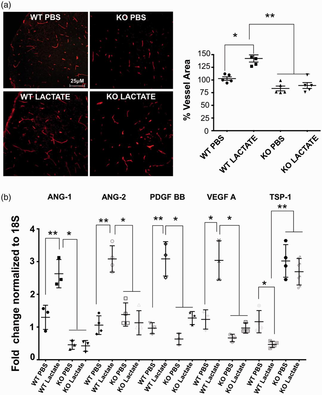誉嘉医学文献分析｜新生儿缺氧缺血性脑损伤后还可以恢复吗？能