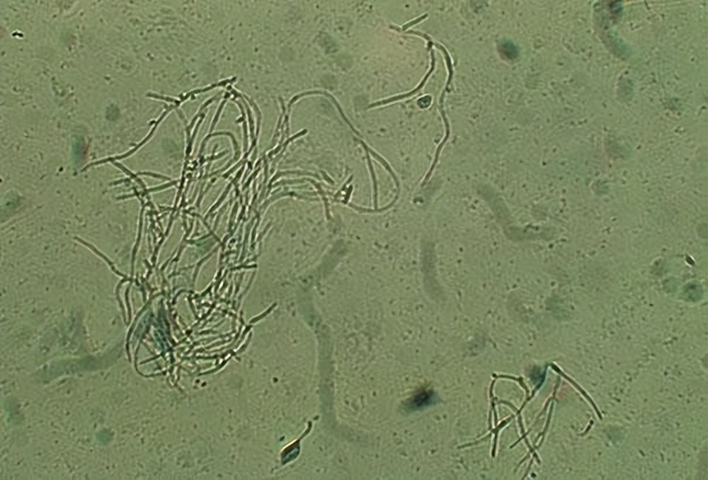 金黄色葡萄球菌的微生物特性,金黄色葡萄球菌的培养特性