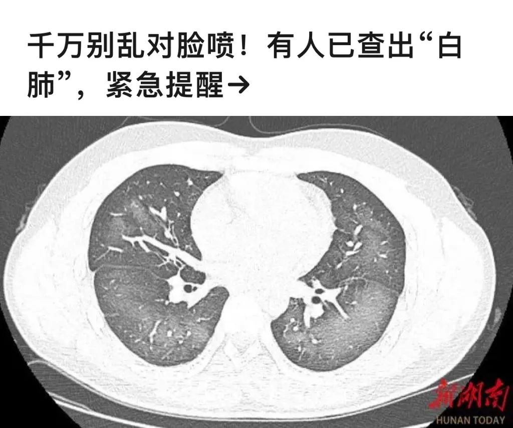 防晒喷雾有毒吗,防晒喷雾到底安不安全