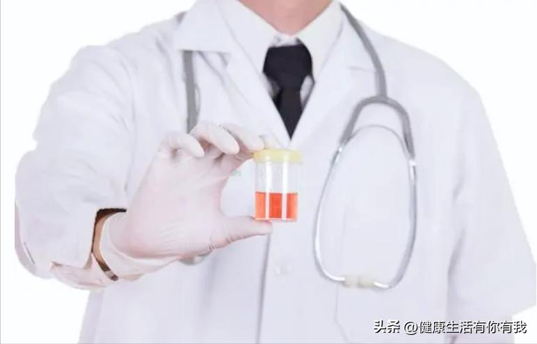 什么是血尿和尿潜血,什么是血尿是怎么回事