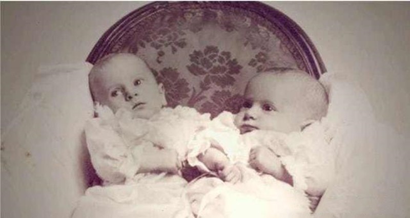 英国连体姐妹分离手术大结局,英国连体姐妹姐姐死后怎样