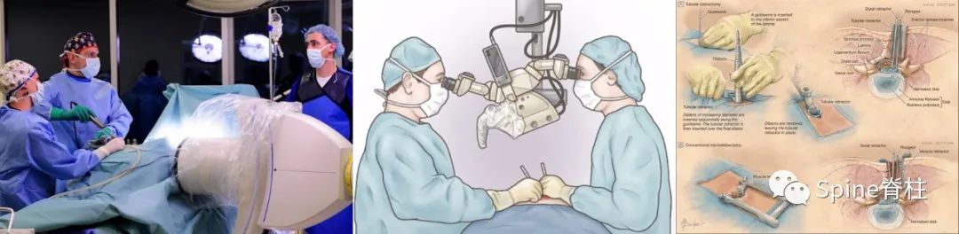 腰椎间盘突出症的治疗方法,腰椎间盘突出症状主要有哪些