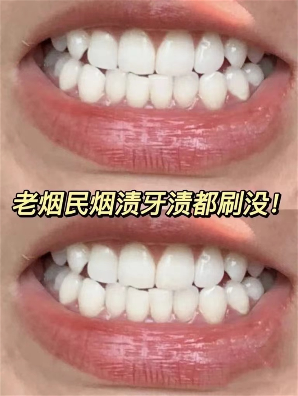 治牙黄口臭教你一招保证牙白,可以让黄牙变白牙的好物推荐