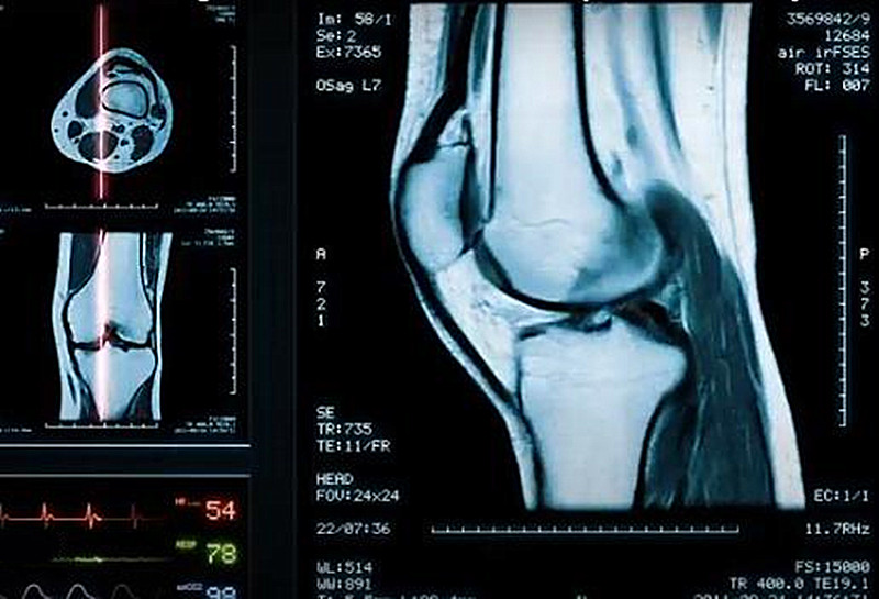 膝盖疼牙疼是什么原因,换了膝盖