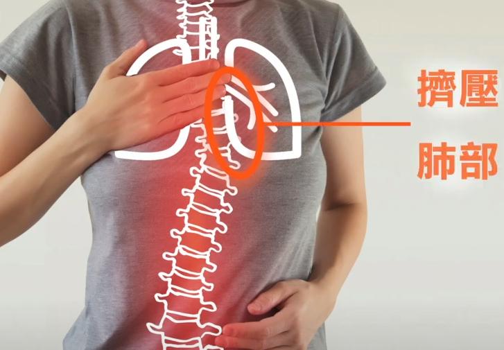 有哪些原因引起脊柱侧弯,有轻微脊柱侧弯怎么办