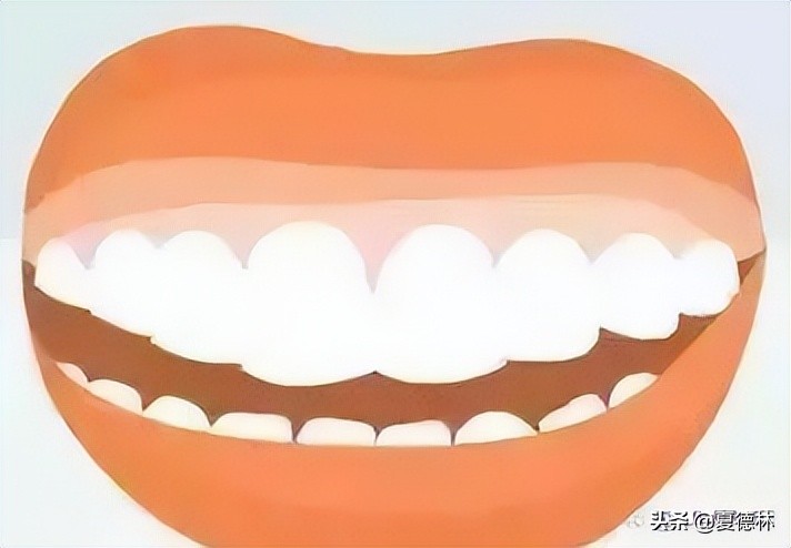 笑起来露牙龈的很难看怎么改善,笑起来不好看露牙龈怎么办