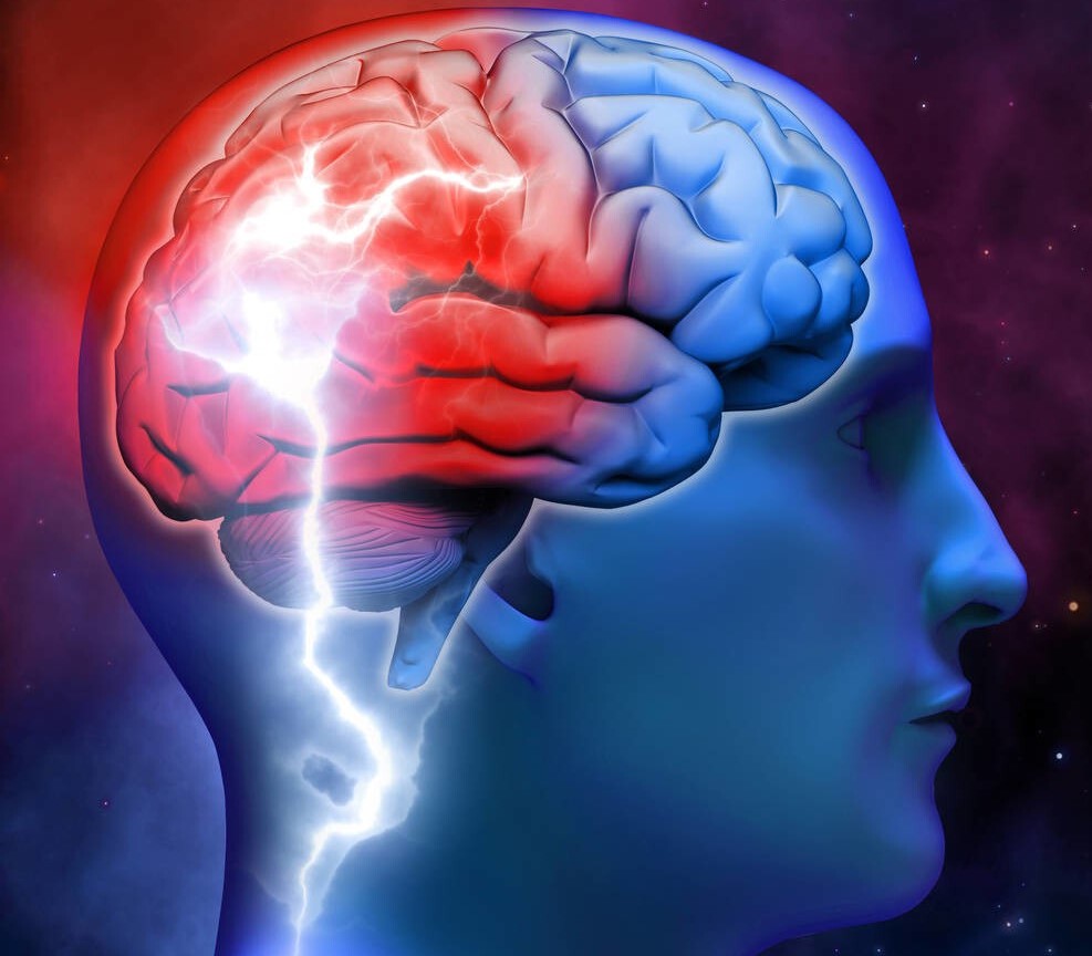 婴儿轻度脑积水是什么原因引起,新生儿轻微脑积水怎么治